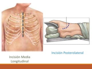 Longitudinal Incsion Tiempos quirúrgicos. Enfermería | PPTX