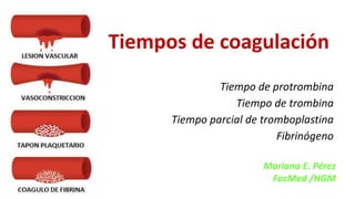 Tiempos de coagulación
Tiempo de protrombina
Tiempo de trombina
Tiempo parcial de tromboplastina
Fibrinógeno
Mariana E. Pérez
FacMed /HGM
 