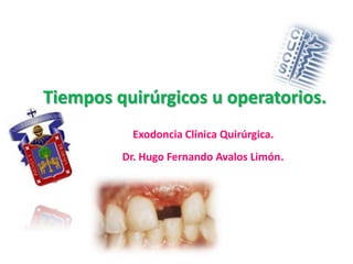 Tiempos quirúrgicos u operatorios.
Exodoncia Clínica Quirúrgica.
Dr. Hugo Fernando Avalos Limón.

 