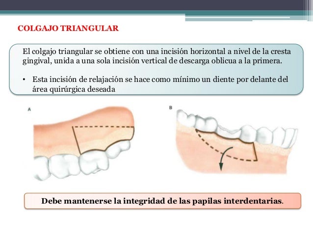 Tiempos operatorios en cirugía bucal