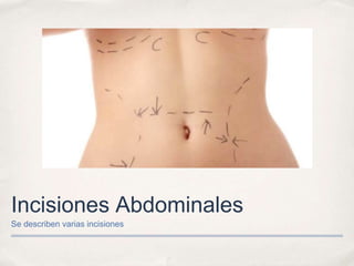 Incisiones Abdominales
Se describen varias incisiones
 