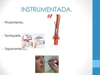 INSTRUMENTADA.
• Pinzamiento.



• Torniquete.



• Taponamiento.
 