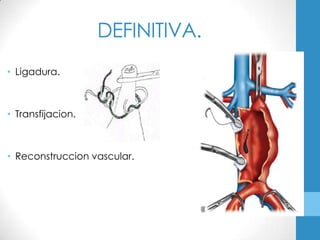 DEFINITIVA.
• Ligadura.



• Transfijacion.



• Reconstruccion vascular.
 