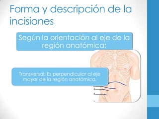 Forma y descripción de la
incisiones
 Según la orientación al eje de la
       región anatómica:


 Transversal: Es perpendicular al eje
   mayor de la región anatómica.
 
