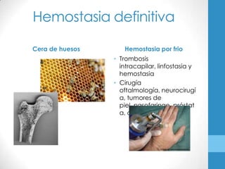 Hemostasia definitiva

Cera de huesos      Hemostasia por frio
                 • Trombosis
                   intracapilar, linfostasia y
                   hemostasia
                 • Cirugía
                   oftalmología, neurocirugí
                   a, tumores de
                   piel, nasofaringe, próstat
                   a, cuello uterino.
 