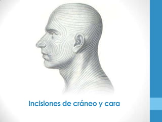 Incisiones de cráneo y cara
 