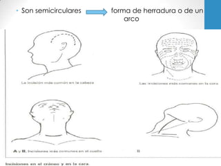 • Son semicirculares   forma de herradura o de un
                           arco
 