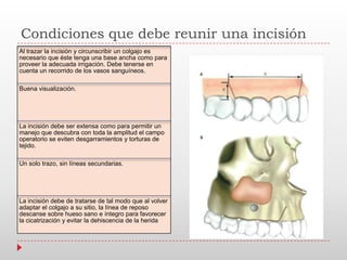 Condiciones que debe reunir una incisión
Al trazar la incisión y circunscribir un colgajo es
necesario que éste tenga una base ancha como para
proveer la adecuada irrigación. Debe tenerse en
cuenta un recorrido de los vasos sanguíneos.
Buena visualización.
La incisión debe ser extensa como para permitir un
manejo que descubra con toda la amplitud el campo
operatorio se eviten desgarramientos y torturas de
tejido.
Un solo trazo, sin líneas secundarias.
La incisión debe de tratarse de tal modo que al volver
adaptar el colgajo a su sitio, la línea de reposo
descanse sobre hueso sano e íntegro para favorecer
la cicatrización y evitar la dehiscencia de la herida
 