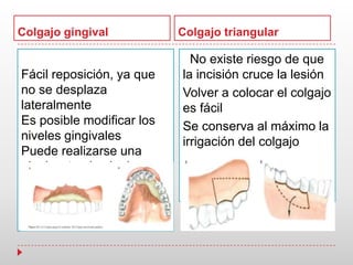 Colgajo gingival Colgajo triangular
Fácil reposición, ya que
no se desplaza
lateralmente
Es posible modificar los
niveles gingivales
Puede realizarse una
gingivectomia al mismo
tiempo
No existe riesgo de que
la incisión cruce la lesión
Volver a colocar el colgajo
es fácil
Se conserva al máximo la
irrigación del colgajo
 