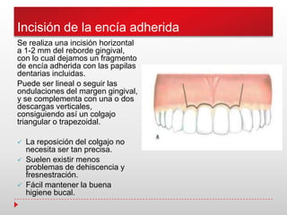 Incisión de la encía adherida
Se realiza una incisión horizontal
a 1-2 mm del reborde gingival,
con lo cual dejamos un fragmento
de encía adherida con las papilas
dentarias incluidas.
Puede ser lineal o seguir las
ondulaciones del margen gingival,
y se complementa con una o dos
descargas verticales,
consiguiendo así un colgajo
triangular o trapezoidal.
 La reposición del colgajo no
necesita ser tan precisa.
 Suelen existir menos
problemas de dehiscencia y
fresnestración.
 Fácil mantener la buena
higiene bucal.
 