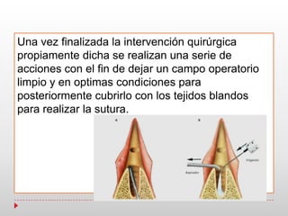 Una vez finalizada la intervención quirúrgica
propiamente dicha se realizan una serie de
acciones con el fin de dejar un campo operatorio
limpio y en optimas condiciones para
posteriormente cubrirlo con los tejidos blandos
para realizar la sutura.
 