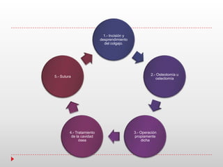 1.- Incisión y
desprendimiento
del colgajo.
2.- Osteotomía u
ostectomía
3.- Operación
propiamente
dicha
4.- Tratamiento
de la cavidad
ósea
5.- Sutura
 