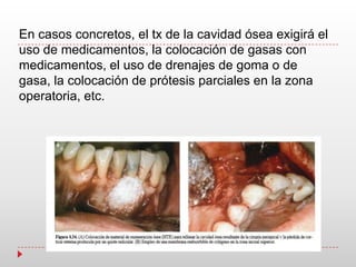 En casos concretos, el tx de la cavidad ósea exigirá el
uso de medicamentos, la colocación de gasas con
medicamentos, el uso de drenajes de goma o de
gasa, la colocación de prótesis parciales en la zona
operatoria, etc.
 
