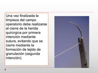 Una vez finalizada la
limpieza del campo
operatorio debe realizarse
el cierre de la herida
quirúrgica por primera
intención mediante
sutura, evitando que se
cierre mediante la
formación de tejido de
granulación (segunda
intención).
 