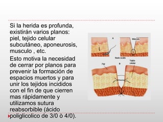 Si la herida es profunda,
existirán varios planos:
piel, tejido celular
subcutáneo, aponeurosis,
musculo , etc.
Esto motiva la necesidad
de cerrar por planos para
prevenir la formación de
espacios muertos y para
unir los tejidos incididos
con el fin de que cierren
mas rápidamente y
utilizamos sutura
reabsorbible (ácido
poliglicolico de 3/0 ò 4/0).
 