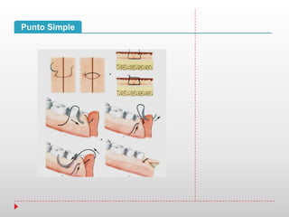 Punto Simple
 