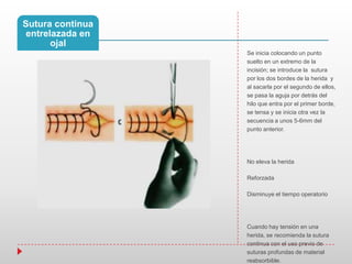 Sutura continua
entrelazada en
ojal
Se inicia colocando un punto
suelto en un extremo de la
incisión; se introduce la sutura
por los dos bordes de la herida y
al sacarla por el segundo de ellos,
se pasa la aguja por detrás del
hilo que entra por el primer borde,
se tensa y se inicia otra vez la
secuencia a unos 5-6mm del
punto anterior.
No eleva la herida
Reforzada
Disminuye el tiempo operatorio
Cuando hay tensión en una
herida, se recomienda la sutura
continua con el uso previo de
suturas profundas de material
reabsorbible.
 