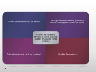 Sutura dérmica profunda de tensión
Vendaje adhesivo, elástico y contra la
tensión, atravesando la línea de sutura.
Sutura intradérmica continua (estética). Vendaje Compresivo
Cuando es necesario
reforzar la sutura cutánea,
pueden emplearse varios
métodos:
 