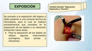 EXPOSICIÓN
Se procede a la exposición del órgano o
tejido posterior a una correcta técnica de
hemostasia, para lo cual se realizan
procedimientos que consisten en la
separación de los tejidos o su retracción
(retracción hacia atrás).
● Para la separación de los tejidos se
utilizan algunos instrumentos
quirúrgicos, tipos pinzas y
retractores.
También llamada “Separación,
Aspiración y Tracción”
 