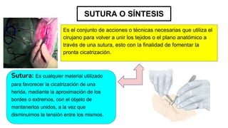 SUTURA O SÍNTESIS
Es el conjunto de acciones o técnicas necesarias que utiliza el
cirujano para volver a unir los tejidos o el plano anatómico a
través de una sutura, esto con la finalidad de fomentar la
pronta cicatrización.
Sutura: Es cualquier material utilizado
para favorecer la cicatrización de una
herida, mediante la aproximación de los
bordes o extremos, con el objeto de
mantenerlos unidos, a la vez que
disminuimos la tensión entre los mismos.
 
