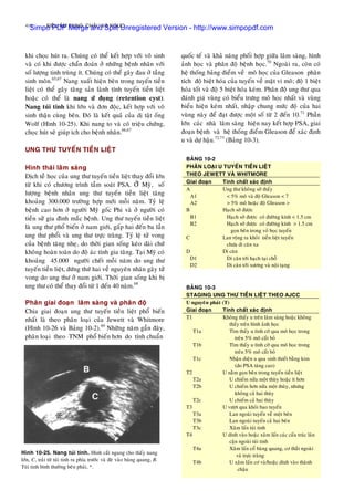 416 SIEÂU AÂM BUÏNG, CHAÄU VAØ NGÖÏC
khi choïc huùt ra. Chuùng coù theå keát hôïp vôùi voâ sinh
vaø coù khi ñöôïc chaån ñoaùn ôû nhöõng beänh nhaân vôùi
soá löôïng tinh truøng ít. Chuùng coù theå gaây ñau ôû taàng
sinh moân.65,67
Nang xuaát hieän beân trong tuyeán tieàn
lieät coù theå gaây taêng saûn laønh tính tuyeán tieàn lieät
hoaëc coù theå laø nang öù ñoïng (retention cyst).
Nang tuùi tinh khi lôùn vaø ñôn ñoäc, keát hôïp vôùi voâ
sinh thaän cuøng beân. Ñoù laø keát quaû cuûa dò taät oáng
Wolf (Hình 10-25). Khi nang to vaø coù trieäu chöùng,
choïc huùt seõ giuùp ích cho beänh nhaân.66,67
UNG THÖ TUYEÁN TIEÀN LIEÄT
Hình thaùi laâm saøng
Dòch teã hoïc cuûa ung thö tuyeán tieàn lieät thay ñoåi lôùn
töø khi coù chöông trình taàm soaùt PSA. ÔÛû Myõ, soá
löôïng beänh nhaân ung thö tuyeán tieàn lieät taêng
khoaûng 300.000 tröôøng hôïp môùi moãi naêm. Tyû leä
beänh cao hôn ôû ngöôøi Myõ goác Phi vaø ôû ngöôøi coù
tieàn söû gia ñình maéc beänh. Ung thö tuyeán tieàn lieät
laø ung thö phoå bieán ôû nam giôùi, gaáp hai ñeán ba laàn
ung thö phoåi vaø ung thö tröïc traøng. Tyû leä töû vong
cuûa beänh taêng nheï, do thôøi gian soáng keùo daøi chöù
khoâng hoaøn toaøn do ñoä aùc tính gia taêng. Taïi Myõ coù
khoaûng 45.000 ngöôøi cheát moãi naêm do ung thö
tuyeán tieàn lieät, ñöùng thöù hai veà nguyeân nhaân gaây töû
vong do ung thö ôû nam giôùi. Thôøi gian soáng khi bò
ung thö coù theå thay ñoåi töø 1 ñeán 40 naêm.68
Phaân giai ñoaïn laâm saøng vaø phaân ñoä
Chia giai ñoaïn ung thö tuyeán tieàn lieät phoå bieán
nhaát laø theo phaân loaïi cuûa Jewett vaø Whitmore
(Hình 10-26 vaø Baûng 10-2).69
Nhöõng naêm gaàn ñaây,
phaân loaïi theo TNM phoå bieán hôn do tính chuaån
quoác teá vaø khaû naêng phoái hôïp giöõa laâm saøng, hình
aûnh hoïc vaø phaân ñoä beänh hoïc.70
Ngoaøi ra, coøn coù
heä thoáng baûng ñieåm veà moâ hoïc cuûa Gleason phaân
tích ñoä bieät hoùa cuûa tuyeán veà maët vi moâ; ñoä 1 bieät
hoùa toát vaø ñoä 5 bieät hoùa keùm. Phaân ñoä ung thö qua
ñaùnh giaù vuøng coù bieåu tröng moâ hoïc nhaát vaø vuøng
bieåu hieän keùm nhaát, nhaäp chung möùc ñoä cuûa hai
vuøng naøy ñeå ñaït ñöôïc moät soá töø 2 ñeán 10.71
Phaàn
lôùn caùc nhaø laâm saøng hieän nay keát hôïp PSA, giai
ñoaïn beänh vaø heä thoáng ñieåm Gleason ñeå xaùc ñònh
u vaø döï haäu.72,73
(Baûng 10-3).
BAÛNG 10-2
PHAÂN LOAÏI U TUYEÁN TIEÀN LIEÄT
THEO JEWETT VAØ WHITMORE
Giai ñoaïn Tính chaát xaùc ñònh
A
A1
A2
B
B1
B2
C
D
D1
D2
Ung thö khoâng sôø thaáy
< 5% moâ vaø ñoä Gleason < 7
> 5% moâ hoaëc ñoä Gleason >
Haïch sôø ñöôïc
Haïch sôø ñöôïc coù ñöôøng kính < 1.5 cm
Haïch sôø ñöôïc coù ñöôøng kính > 1.5 cm
goïn beân trong voû boïc tuyeán
Lan roäng ra khoûi tieàn lieät tuyeán
chöa di caên xa
Di caên
Di caên tôùi haïch taïi choã
Di caên tôùi xöông vaø noäi taïng
BAÛNG 10-3
STAGING UNG THÖ TIEÀN LIEÄT THEO AJCC
U nguyeân phaùt (T)
Giai ñoaïn Tính chaát xaùc ñònh
T1
T1a
T1b
T1c
T2
T2a
T2b
T2c
T3
T3a
T3b
T3c
T4
T4a
T4b
Khoâng thaáy u treân laâm saøng hoaëc khoâng
thaáy treân hình aûnh hoïc
Tìm thaáy u tình côø qua moâ hoïc trong
treân 5% moâ caét boû
Tìm thaáy u tình côø qua moâ hoïc trong
treân 5% moâ caét boû
Nhaän dieän u qua sinh thieát baèng kim
(do PSA taêng cao)
U naèm goïn beân trong tuyeán tieàn lieät
U chieám nöûa moät thuøy hoaëc ít hôn
U chieám hôn nöûa moät thuøy, nhöng
khoâng caû hai thuøy
U chieám caû hai thuøy
U vöôït qua khoûi bao tuyeán
Lan ngoaøi tuyeán veà moät beân
Lan ngoaøi tuyeán caû hai beân
Xaâm laán tuùi tinh
U dính vaøo hoaëc xaâm laán caùc caáu truùc laân
caän ngoaøi tuùi tinh
Xaâm laán coå baøng quang, cô thaét ngoaøi
vaø tröïc traøng
U xaâm laán cô vaø/hoaëc dính vaøo thaønh
chaäu
Hình 10-25. Nang tuùi tinh. Hình caét ngang cho thaáy nang
lôùn, C, traûi töø tuùi tinh ra phía tröôùc vaø ñeø vaøo baøng quang, B.
Tuùi tinh bình thöôøng beân phaûi, *.
Simpo PDF Merge and Split Unregistered Version - http://www.simpopdf.com
 
