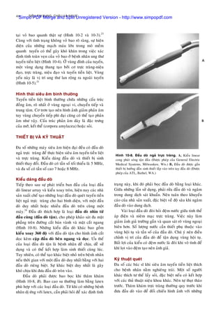 SIEÂU AÂM BUÏNG, CHAÄU VAØ NGÖÏC406
taïi voû bao quanh thaät söï (Hình 10-2 vaø 10-3).23
Cuøng vôùi tình traïng khoâng voû bao roõ raøng, söï hieän
dieän cuûa nhöõng maïch maùu lôùn trong moâ meàm
quanh tuyeán coù theå gaây khoù khaên trong vieäc xaùc
ñònh tính toaøn veïn cuûa voû bao ôû beänh nhaân ung thö
tuyeán tieàn lieät (Hình 10-4). ÔÛ vuøng ñænh cuûa tuyeán,
moät vuøng daïng thang taïo bôûi cô tröïc traøng-nieäu
ñaïo, tröïc traøng, nieäu ñaïo vaø tuyeán tieàn lieät. Vuøng
yeáu naøy laø vò trí ung thö lan roäng ra ngoaøi tuyeán
(Hình 10-5).21
Hình thaùi sieâu aâm bình thöôøng
Tuyeán tieàn lieät bình thöôøng chöùa nhöõng caáu truùc
ñoàng aâm, roõ nhaát ôû vuøng ngoaïi vi, chuyeån tieáp vaø
trung taâm. Cô trôn taïo neân hình aûnh giaûm phaûn aâm
tuy vuøng chuyeån tieáp phì ñaïi cuõng coù theå taïo phaûn
aâm nhö vaäy. Caáu truùc phaûn aâm daøy laø ñaëc tröng
cuûa môõ, keát theå (corpora amylacea) hoaëc soûi.
THIEÁT BÒ VAØ KYÕ THUAÄT
Ña soá nhöõng maùy sieâu aâm hieän ñaïi ñeàu coù ñaàu doø
ngaû tröïc traøng ñeå thöïc hieän sieâu aâm tuyeán tieàn lieät
vaø tröïc traøng. Kieåu daùng ñaàu doø vaø thieát bò sinh
thieát thay ñoåi. Ñaàu doø coù taàn soá toái thieåu laø 5 MHz,
vaø ña soá coù taàn soá cao 7 hoaëc 8 MHz.
Kieåu daùng ñaàu doø
Tieáp theo sau söï phaùt trieån ban ñaàu cuûa loaïi ñaàu
doø linear array vaø kieåu xoay troøn, hieän nay caùc nhaø
saûn xuaát cheá taïo nhöõng loaïi ñaàu doø queùt tuyeán tieàn
lieät ngaû tröïc traøng cho hai bình dieän, vôùi moät ñaàu
doø duy nhaát hoaëc nhieàu ñaàu doø treân cuøng moät
maùy.24
Ñaàu doø thích hôïp laø loaïi ñaàu doø nhìn töø
ñaàu cuøng (ñaàu doø taän), cho pheùp khaûo saùt ña maët
phaúng treân ñöôøng caét baùn vaønh vaø maët caét ngang
(Hình 10-8). Nhöõng kieåu ñaàu doø khaùc bao goàm
kieåu xoay 360 ñoä vôùi ñaàu doø taän cho hình aûnh caét
doïc keøm caëp ñaàu doø beân ngang vaø doïc. Öu theá
cuûa loaïi ñaàu doø taän laø beänh nhaân deã chòu, deã söû
duïng vaø coù theå keát hôïp laøm sinh thieát cuøng luùc.
Tuy nhieân, coù theå taïo khaùc bieät nhoû treân beänh nhaân
neáu thôøi gian vôùi moät ñaàu doø duy nhaát baèng vôùi hai
ñaàu doø rieâng bieät. Söï khaùc bieät duy nhaát laø gaây
khoù chòu khi ñöa ñaàu doø troøn vaøo.
Ñaàu doø phaûi ñöôïc bao boïc khi thaêm khaùm
(Hình 10-8, B). Bao cao su thöôøng laøm baèng latex
phuø hôïp vôùi caùc loaïi ñaàu doø. Töø khi coù nhöõng beänh
nhaân dò öùng vôùi latex, caàn phaûi hoûi ñeå xaùc ñònh tình
Hình 10-8. Ñaàu doø ngaû tröïc traøng. A, Kieåu linear
cong phaùt soùng taän ñaàu (Ñöôïc pheùp cuûa General Electric
Medical Syatems, Milwaukee, Wis.) B, Ñaàu doø ñöôïc gaén
thieát bò höôùng daãn sinh thieát laép vaøo treân tay ñaàu doø (Ñöôïc
pheùp cuûa ATL, Bathel, WA.)
traïng naøy, khi ñoù phaûi boïc ñaàu doø baèng loaïi khaùc.
Giöõa nhöõng laàn söû duïng, phaûi röûa ñaàu doø vaø ngaâm
trong dung dòch saùt khuaån. Neân tuaân theo khuyeán
caùo cuûa nhaø saûn xuaát, ñaëc bieät veà ñoä saâu khi ngaâm
ñaàu doø vaøo dung dòch.
Vaøi loaïi ñaàu doø ñoøi hoûi ñeäm nöôùc giöõa tinh theå
aùp ñieän vaø nieâm maïc tröïc traøng. Vieäc naøy laøm
giaûm aûnh giaû tröôøng gaàn vaø quan saùt roõ vuøng ngoaïi
bieân hôn. Soá löôïng nöôùc caàn thieát phuï thuoäc vaøo
vuøng hoäi tuï vaø taàn soá cuûa ñaàu doø. Chuù yù neân ñieàu
chænh vò trí cuûa ñaàu doø ñeå taän duïng vuøng hoäi tuï.
Baát lôïi cuûa kieåu coù ñeäm nöôùc laø ñoâi khi voâ tình ñeå
khí loït vaøo ñeäm taïo neân aûnh giaû.
Kyõ thuaät queùt
Ña soá caùc baùc só khi sieâu aâm tuyeán tieàn lieät thích
cho beänh nhaân naèm nghieâng traùi. Moät soá ngöôøi
khaùc thích tö theá laáy soûi, ñaëc bieät neáu coù keát hôïp
vôùi caùc thuû thuaät nieäu khoa khaùc. Neân töï thuït thaùo
tröôùc. Thaêm khaùm tröïc traøng thöôøng quy tröôùc khi
ñöa ñaàu doø vaøo ñeå ñoái chieáu hình aûnh vôùi nhöõng
Simpo PDF Merge and Split Unregistered Version - http://www.simpopdf.com
 
