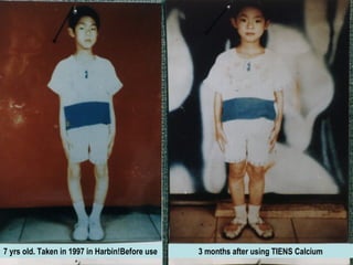 7 yrs old. Taken in 1997 in Harbin!Before use   3 months after using TIENS Calcium
 
