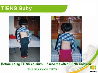 TIENS Baby




Before using TIENS calcium   2 months after TIENS Calcium
 