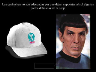 Las cachuchas no son adecuadas por que deja n  expuestas al sol algunas partes delicadas de la oreja Fascinante 