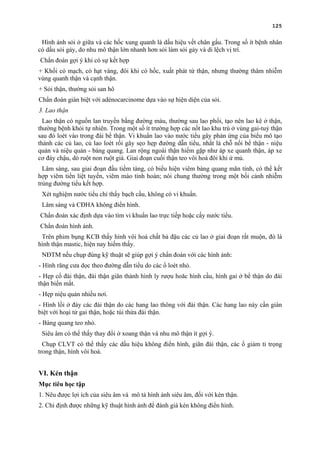 125
Hình ảnh sỏi ở giữa và các hốc xung quanh là dấu hiệu vết chân gấu. Trong số ít bệnh nhân
có dấu sỏi gảy, do nhu mô thận lớn nhanh hơn sỏi làm sỏi gảy và di lệch vị trí.
Chẩn đoán gợi ý khi có sự kết hợp
+ Khối có mạch, có hạt vàng, đôi khi có hốc, xuất phát từ thận, nhưng thường thâm nhiễm
vùng quanh thận và cạnh thận.
+ Sỏi thận, thường sỏi san hô
Chẩn đoán gián biệt với adénocarcinome dựa vào sự hiện diện của sỏi.
3. Lao thận
Lao thận có nguồn lan truyền bằng đường máu, thường sau lao phổi, tạo nên lao kê ở thận,
thường bệnh khỏi tự nhiên. Trong một số ít trường hợp các nốt lao khu trú ở vùng gai-tuỷ thận
sau đó loét vào trong đài bể thận. Vi khuẩn lao vào nước tiểu gây phản ứng của biểu mô tạo
thành các củ lao, củ lao loét rồi gây sẹo hẹp đường dẫn tiểu, nhất là chỗ nối bể thận - niệu
quản và niệu quản - bàng quang. Lan rộng ngoài thận hiếm gặp như áp xe quanh thận, áp xe
cơ đáy chậu, dò ruột non ruột già. Giai đoạn cuối thận teo vôi hoá đôi khi ứ mủ.
Lâm sàng, sau giai đoạn đầu tiềm tàng, có biểu hiện viêm bàng quang mãn tính, có thể kết
hợp viêm tiền liệt tuyến, viêm mào tinh hoàn; nói chung thường trong một bối cảnh nhiễm
trùng đường tiểu kết hợp.
Xét nghiệm nước tiểu chỉ thấy bạch cầu, không có vi khuẩn.
Lâm sàng và CĐHA không điển hình.
Chẩn đoán xác định dựa vào tìm vi khuẩn lao trực tiếp hoặc cấy nước tiểu.
Chẩn đoán hình ảnh.
Trên phim bụng KCB thấy hình vôi hoá chất bả đậu các củ lao ở giai đoạn rất muộn, đó là
hình thận mastic, hiện nay hiếm thấy.
NĐTM nếu chụp đúng kỹ thuật sẽ giúp gợi ý chẩn đoán với các hình ảnh:
- Hình răng cưa dọc theo đường dẫn tiểu do các ổ loét nhỏ.
- Hẹp cổ đài thận, đài thận giãn thành hình ly rượu hoăc hình cầu, hình gai ở bể thận do đài
thận biến mất.
- Hẹp niệu quản nhiều nơi.
- Hình lồi ở đáy các đài thận do các hang lao thông với đài thận. Các hang lao này cần gián
biệt với hoại tử gai thận, hoặc túi thừa đài thận.
- Bàng quang teo nhỏ.
Siêu âm có thể thấy thay đổi ở xoang thận và nhu mô thận ít gợi ý.
Chụp CLVT có thể thấy các dấu hiệu không điển hình, giãn đài thận, các ổ giảm tỉ trọng
trong thận, hình vôi hoá.
VI. Kén thận
Mục tiêu học tập
1. Nêu được lợi ích của siêu âm và mô tả hình ảnh siêu âm, đối với kén thận.
2. Chỉ định được những kỹ thuật hình ảnh để đánh giá kén không điển hình.
 