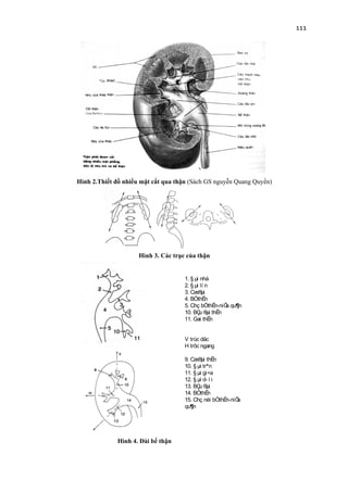 111
Hình 2.Thiết đồ nhiều mặt cắt qua thận (Sách GS nguyễn Quang Quyền)
Hình 3. Các trục của thận
Hình 4. Đài bể thận
1. § µi nhá
2. § µi lí n
3. Cæ®µi
4. BÓthËn
5. Chç bÓthËn-niÖu qu¶n
10. BÇu ®µi thËn
11. Gai thËn
V trùc däc
H trôc ngang
9. Cæ®µi thËn
10. § µi trªn
11. § µi gi÷a
12. § µi d- í i
13. BÇu ®µi
14. BÓthËn
15. Chç nèi bÓthËn-niÖu
qu¶n
 