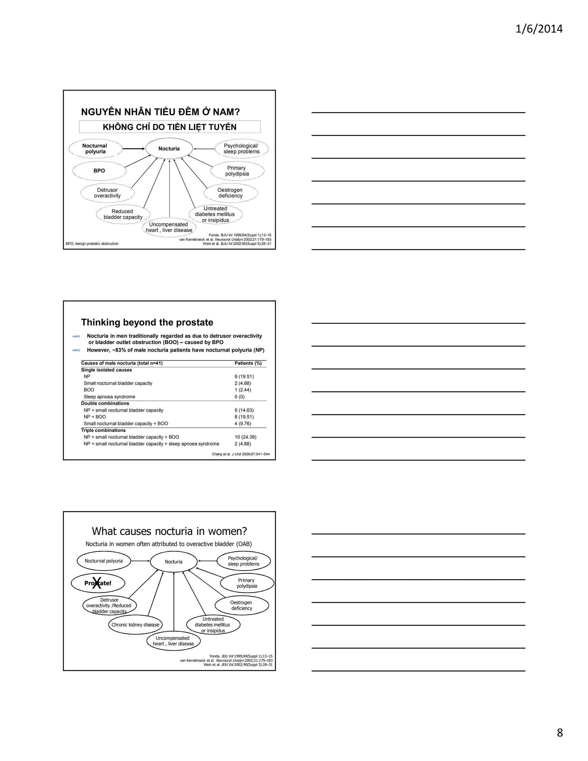 1/6/2014
8
NGUYÊN NHÂN TIỂU ĐÊM Ở NAM?
Psychological/
sleep problems
Primary
polydipsia
Oestrogen
deficiency
Detrusor
overactivity
Uncompensated
heart , liver disease
Reduced
bladder capacity
Nocturia
Fonda. BJU Int 1999;84(Suppl 1):13–15
van Kerrebroeck et al. Neurourol Urodyn 2002;21:179–183
Wein et al. BJU Int 2002;90(Suppl 3):28–31
Untreated
diabetes mellitus
or insipidus
BPO
Nocturnal
polyuria
KHÔNG CHỈ DO TIỀN LIỆT TUYẾN
BPO, benign prostatic obstruction
Nocturia in men traditionally regarded as due to detrusor overactivity
or bladder outlet obstruction (BOO) – caused by BPO
However, ~83% of male nocturia patients have nocturnal polyuria (NP)
Causes of male nocturia (total n=41) Patients (%)
Single isolated causes
NP 8 (19.51)
Small nocturnal bladder capacity 2 (4.88)
BOO 1 (2.44)
Sleep apnoea syndrome 0 (0)
Double combinations
NP + small nocturnal bladder capacity 6 (14.63)
NP + BOO 8 (19.51)
Small nocturnal bladder capacity + BOO 4 (9.76)
Triple combinations
NP + small nocturnal bladder capacity + BOO 10 (24.39)
NP + small nocturnal bladder capacity + sleep apnoea syndrome 2 (4.88)
Thinking beyond the prostate
Chang et al. J Urol 2006;67:541–544
Fonda. BJU Int 1999;84(Suppl 1):13–15
van Kerrebroeck et al. Neurourol Urodyn 2002;21:179–183
Wein et al. BJU Int 2002;90(Suppl 3):28–31
Nocturia in women often attributed to overactive bladder (OAB)
Prostate!
X
Psychological/
sleep problems
Primary
polydipsia
Oestrogen
deficiency
Detrusor
overactivity /Reduced
bladder capacity
Uncompensated
heart , liver disease
Chronic kidney disease
Nocturia
Untreated
diabetes mellitus
or insipidus
Nocturnal polyuria
What causes nocturia in women?
 
