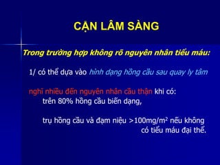 CẬN LÂM SÀNG
Trong trường hợp không rõ nguyên nhân tiểu máu:
1/ có thể dựa vào hình dạng hồng cầu sau quay ly tâm
nghĩ nhiều đến nguyên nhân cầu thận khi có:
trên 80% hồng cầu biến dạng,
trụ hồng cầu và đạm niệu >100mg/m2 nếu không
có tiểu máu đại thể.
 