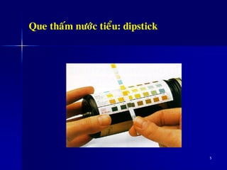 5
Que thaám nöôùc tieåu: dipstick
 