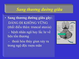 Sang thương đường giữa
• Sang thương đường giữa gây:
DÁNG ĐI KHÔNG VỮNG
(thaát ñieàu thaân: truncal ataxia)
- bệnh nhân ngã hay lắc lư về
bên tổn thương
- thoái hóa thùy giun xảy ra
trong ngộ độc rượu mãn
 