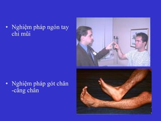 • Nghiệm pháp ngón tay
chỉ mũi
• Nghiệm pháp gót chân
-cẳng chân
 