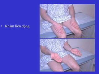 • Khám liên động
 