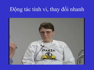 Động tác tinh vi, thay đổi nhanh
 