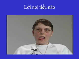 Lời nói tiểu não
 