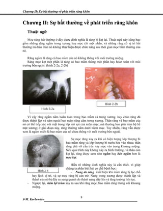 Chương II: Sự bất thường về phát triển răng khôn


Chương II: Sự bất thường về phát triển răng khôn
   Thuật ngữ
    Mọc răng bất thường ở đây được định nghĩa là răng bị kẹt lại. Thuật ngữ này cũng bao
gồm những răng ngầm trong xương hay mọc chỉ một phần, và những răng có vị trí bất
thường mà bản thân nó không thực hiện được chức năng sau thời gian mọc bình thường của
nó.

    Răng ngầm là răng có bao mầm của nó không thông với môi trường miệng.
    Răng mọc kẹt một phần là răng có bao mầm thông một phần hay hoàn toàn với môi
trường bên ngoài. (hình 2-2a; 2-2b)




                                                             Hình 2-2b
              Hình 2-2a

   Vì vậy răng ngầm nằm hoàn toàn trong bao mầm và trong xương, hay chân răng đã
được thành lập và nằm ngoài bao mầm răng cắm trong xương. Thân răng và bao mầm của
nó có thể tiếp xúc với mặt trong lớp mô sợi của niêm mạc, mà thường bao phủ toàn bộ bề
mặt xương; ở giai đoạn này, răng thường nằm dưới niêm mạc. Tuy nhiên, răng vẫn được
xem là ngầm miễn là bao mầm của nó chưa thông với môi trường bên ngoài.

                                    Sự mọc răng xảy ra khi có hiện tượng lớp thượng bì
                                bao mầm răng và lớp thượng bì nướu hòa vào nhau; thân
                                răng phá vỡ cấu trúc này mọc vào trong khoang miệng.
                                Nếu quá trình này không xảy ra bình thường, và thân còn
                                kẹt lại, răng được xem như ngầm hay bán ngầm hơn là
                                mọc kẹt.

                                    Hiểu rõ những định nghĩa này là cần thiết, vì giúp
                                 chúng ta phân biệt hai cơ chế bệnh học:
           Hình 2-4                 - Nang do răng xuất hiện khi mầm răng bị lạc chổ
       hay lệch vị trí, và sự mọc răng bị cản trở. Nang trong xương được thành lập và
       thành của nó bị đẩy ra xung quanh do thành nang dày lên và tăng trưởng liên tục.
   -   Ngược lại, viêm lợi trùm xảy ra sau khi răng mọc, bao mầm răng thông với khoang
       miệng.


J-M. Korbendau  ______________8_____________________
 