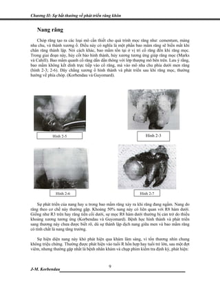 Chương II: Sự bất thường về phát triển răng khôn


   Nang răng
    Chóp răng tạo ra các loại mô cần thiết cho quá trình mọc răng như: cementum, màng
nha chu, và thành xương ổ. Điều này có nghĩa là một phần bao mầm răng sẽ biến mất khi
chân răng thành lập. Nói cách khác, bao mầm tồn tại ở vị trí cổ răng đến khi răng mọc.
Trong giai đoạn này, hủy cốt bào hình thành, hủy xương tương ứng giúp răng mọc (Marks
và Cahill). Bao mầm quanh cổ răng dần dần thông với lớp thượng mô bên trên. Lưu ý rằng,
bao mầm không kết dính trực tiếp vào cổ răng, mà vào mô nha chu phía dưới men răng
(hình 2-3; 2-6). Dây chằng xương ổ hình thành và phát triển sau khi răng mọc, thường
hướng về phía chóp. (Korbendau và Guyomard).




            Hình 2-5                                            Hình 2-3




              Hình 2-6                                       Hình 2-7

    Sự phát triển của nang hay u trong bao mầm răng xảy ra khi răng đang ngầm. Nang do
răng theo cơ chế này thường gặp. Khoảng 50% nang này có liên quan với R8 hàm dưới.
Giống như R3 trên hay răng tiền cối dưới, sự mọc R8 hàm dưới thường bị cản trở do thiếu
khoảng xương tương ứng (Korbendau và Guyomard). Bệnh học hình thành và phát triển
sang thương này chưa được biết rõ, dù sự thành lập dịch nang giữa men và bao mầm răng
có tính chất là nang tăng trưởng.

   Sự hiện diện nang này khó phát hiện qua khám lâm sàng, vì tổn thương nhìn chung
không triệu chứng. Thường được phát hiện vào tuổi R hổn hợp hay tuổi trẻ lớn, sau một đợt
viêm, nhưng thường gặp nhất là bệnh nhân khám và chụp phim kiểm tra định kỳ, phát hiện:



J-M. Korbendau  ______________9_____________________
 