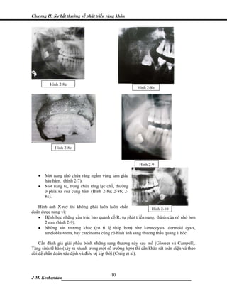 Chương II: Sự bất thường về phát triển răng khôn




          Hình 2-8a
                                                          Hình 2-8b




            Hình 2-8c



                                                           Hình 2-9

   •   Một nang nhỏ chứa răng ngầm vùng tam giác
       hậu hàm. (hình 2-7).
   •   Một nang to, trong chứa răng lạc chổ, thường
       ở phía xa của cung hàm (Hình 2-8a; 2-8b; 2-
       8c).

   Hình ảnh X-ray thì không phải luôn luôn chẩn
                                                               Hình 2-10
đoán được nang vì:
   • Bệnh học những cấu trúc bao quanh cổ R, sự phát triển nang, thành của nó nhỏ hơn
       2 mm (hình 2-9).
   • Những tổn thương khác (có tỉ lệ thấp hơn) như keratocysts, dermoid cysts,
       ameloblastoma, hay carcinoma cũng có hình ảnh sang thương thấu quang 1 hóc.

    Cần đánh giá giải phẫu bệnh những sang thương này sau mổ (Glosser và Campell).
Tăng sinh tế bào (xảy ra nhanh trong một số trường hợp) thì cần khảo sát toàn diện và theo
dõi để chẩn đoán xác định và điều trị kịp thời (Craig et al).



                             10
J-M. Korbendau  ___________________________________
 
