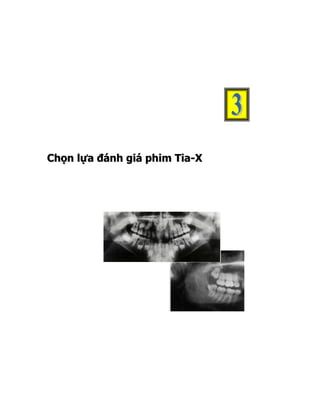 Chọn lựa đánh giá phim Tia-X
 