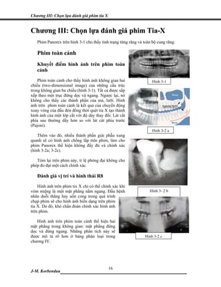 Chương III: Chọn lựa đánh giá phim tia X


Chương III: Chọn lựa đánh giá phim Tia-X
   Phim Panorex trên hình 3-1 cho thấy tình trạng từng răng và toàn bộ cung răng.

   Phim toàn cảnh
   Khuyết điểm hình ảnh trên phim toàn
   cảnh
    Phim toàn cảnh cho thấy hình ảnh không gian hai                 Hình 3-1
chiều (two-dimensional image) của những cấu trúc
trong không gian ba chiều (hình 3-1). Tất cả được sắp
xếp theo một trục đứng dọc và ngang. Ngược lại, nó
không cho thấy các thành phần của má, lưỡi. Hình
ảnh trên phim toàn cảnh là kết quả của chuyển động
xoay vòng của đầu đèn đồng thời quét tia X tạo thành
hình ảnh của một lớp cắt với độ dày thay đổi. Lát cắt
phía sau thường dầy hơn so với lát cát phía trước
(Pajoni).
                                                                    Hình 3-2 a
    Thêm vào đó, nhiều thành phần giải phẫu xung
quanh sẽ có hình ảnh chồng lấp trên phim, làm cho
phim Panorex thể hiện không đầy đủ và chính xác
(hình 3-2a; 3-2c).

   Tóm lại trên phim này, tỉ lệ phóng đại không cho
phép đo đạt một cách chính xác.

   Đánh giá vị trí và hình thái R8
    Hình ảnh trên phim tix X chỉ có thể chính xác khi
vòm miệng là một mặt phẳng nằm ngang. Đầu bệnh                    Hình 3- 2 b
nhân duỗi thẳng hay uốn cong trong quá trình
chụp phim sẽ cho hình ảnh biến dạng trên phim
tia X. Do đó, khó chẩn đoán chính xác hình ảnh
trên phim.

   Hình ảnh trên phim toàn cảnh thể hiện hai
mặt phẳng trong không gian: mặt phẳng đứng
dọc và đứng ngang. Những phân tích này sẽ
được mô tả rõ hơn ở bảng phân loại trong                        Hình 3-2 c
chương IV.




                             16
J-M. Korbendau  ___________________________________
 