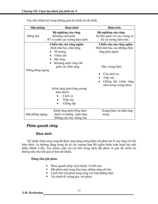 Chương III: Chọn lựa đánh giá phim tia X

   Vậy nên, khám kỹ trong không gian ba chiều là cần thiết.

      Mặt phẳng                  Hàm dưới                             Hàm trên
                       Độ nghiêng của răng                Độ nghiêng của răng
    Đứng dọc           Khoảng cách giữa                  Sự liên quan với các xoang và
                   R7 và cành cao xương hàm dưới             lồi củ xương hàm trên.
                     Chiều sâu của răng ngầm               Chiều sâu của răng ngầm
                     Hình thái học chân răng:            Hình thái học của những chân
                     • Số lượng.                           răng phía ngoài
                     • Chiều dài
                     • Độ cong.
                     • Khoảng cách vùng chẽ
                         giữa các chân răng                       Đáy xoang hàm:
  Thẳng đứng ngang
                                                              •    Còn cách xa.
                                                              •    Tiếp xúc.
                                                              •    Chồng lên (chân răng
                                                                   nằm trong xoang hàm).
                       Kênh răng dưới (ống xương
                         hàm dưới):
                          • Cách xa
                          • Tiếp xúc
                          • Chồng lấp

                        Kênh răng dưới (Ống hàm                   Xoang hàm và chân răng
  Mặt phẳng ngang       dưới) và những chân răng                  trong
                        Những cấu trúc chồng lên.

   Phim quanh chóp
          Hàm dưới
    Kỹ thuật chụp song song đã được ứng dụng trong khảo sát phim tia-X các răng cối lớn
hàm dưới, và thường dùng trong đa số các trường hợp R8 ngầm hoàn toàn hoặc kẹt một
phần (Hình 3-2b). Tuy nhiên, một vài cải tiến trong cách đặt phim và góc độ chiếu tia
dường như cho kết quả rõ hơn rất nhiều.

       Dùng tấm giữ phim

                      Phim quanh chóp: kích thước 31x40 mm.
                      Đặt phim mặt trong theo trục những răng cối lớn.
                      Cạnh trên của phim song song với mặt phẳng nhai.
                      Tia chính đi vuông góc với phim.



                             17
J-M. Korbendau  ___________________________________
 