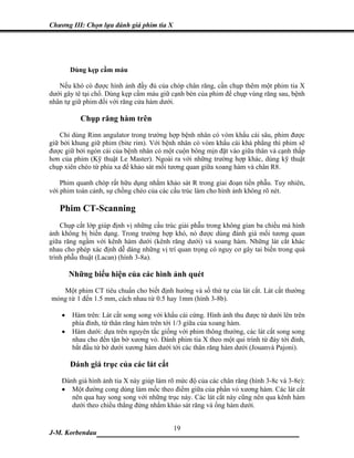 Chương III: Chọn lựa đánh giá phim tia X




        Dùng kẹp cầm máu

   Nếu khó có được hình ảnh đầy đủ của chóp chân răng, cần chụp thêm một phim tia X
dưới gây tê tại chổ. Dùng kẹp cầm máu giữ cạnh bén của phim để chụp vùng răng sau, bệnh
nhân tự giữ phim đối với răng cửa hàm dưới.

           Chụp răng hàm trên
    Chỉ dùng Rinn angulator trong trường hợp bệnh nhân có vòm khẩu cái sâu, phim được
giữ bởi khung giữ phim (bite rim). Với bệnh nhân có vòm khẩu cái khá phẳng thì phim sẽ
được giữ bởi ngón cái của bệnh nhân có một cuộn bông mịn đặt vào giữa thân và cạnh thấp
hơn của phim (Kỹ thuật Le Master). Ngoài ra với những trường hợp khác, dùng kỹ thuật
chụp xiên chéo từ phía xa để khảo sát mối tương quan giữa xoang hàm và chân R8.

    Phim quanh chóp rất hữu dụng nhằm khảo sát R trong giai đoạn tiền phẫu. Tuy nhiên,
với phim toàn cảnh, sự chồng chéo của các cấu trúc làm cho hình ảnh không rõ nét.

   Phim CT-Scanning
    Chụp cắt lớp giúp định vị những cấu trúc giải phẫu trong không gian ba chiều mà hình
ảnh không bị biến dạng. Trong trường hợp khó, nó được dùng đánh giá mối tương quan
giữa răng ngầm với kênh hàm dưới (kênh răng dưới) và xoang hàm. Những lát cắt khác
nhau cho phép xác định dễ dàng những vị trí quan trọng có nguy cơ gây tai biến trong quá
trình phẫu thuật (Lacan) (hình 3-8a).

        Những biểu hiện của các hình ảnh quét
   Một phim CT tiêu chuẩn cho biết định hướng và số thứ tự của lát cắt. Lát cắt thường
mỏng từ 1 đến 1.5 mm, cách nhau từ 0.5 hay 1mm (hình 3-8b).

    •   Hàm trên: Lát cắt song song với khẩu cái cứng. Hình ảnh thu được từ dưới lên trên
        phía đỉnh, từ thân răng hàm trên tới 1/3 giữa của xoang hàm.
    •   Hàm dưới: dựa trên nguyên tắc giống với phim thông thường, các lát cắt song song
        nhau cho đến tận bờ xương vỏ. Đánh phim tia X theo một qui trình từ đáy tới đỉnh,
        bắt đầu từ bờ dưới xương hàm dưới tới các thân răng hàm dưới (Jouanvà Pajoni).

        Đánh giá trục của các lát cắt
    Đánh giá hình ảnh tia X này giúp làm rõ mức độ của các chân răng (hình 3-8c và 3-8e):
    • Một đường cong dùng làm mốc theo điểm giữa của phần vỏ xương hàm. Các lát cắt
       nên qua hay song song với những trục này. Các lát cắt này cũng nên qua kênh hàm
       dưới theo chiều thẳng đứng nhằm khảo sát răng và ống hàm dưới.


                             19
J-M. Korbendau  ___________________________________
 