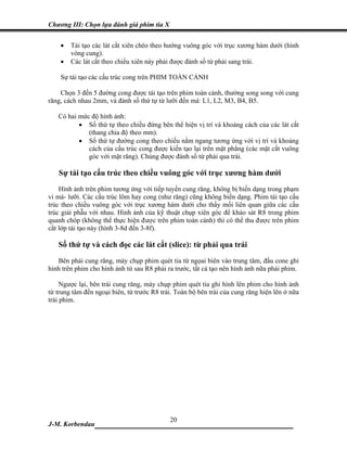 Chương III: Chọn lựa đánh giá phim tia X


    •   Tái tạo các lát cắt xiên chéo theo hướng vuông góc với trục xương hàm dưới (hình
        vòng cung).
    •   Các lát cắt theo chiều xiên này phải được đánh số từ phải sang trái.

    Sự tái tạo các cấu trúc cong trên PHIM TOÀN CẢNH

    Chọn 3 đến 5 đường cong được tái tạo trên phim toàn cảnh, thường song song với cung
răng, cách nhau 2mm, và đánh số thứ tự từ lưỡi đến má: L1, L2, M3, B4, B5.

   Có hai mức độ hình ảnh:
          • Số thứ tự theo chiều đứng bên thể hiện vị trí và khoảng cách của các lát cắt
             (thang chia độ theo mm).
          • Số thứ tự đường cong theo chiều nằm ngang tương ứng với vị trí và khoảng
             cách của cấu trúc cong được kiến tạo lại trên mặt phẳng (các mặt cắt vuông
             góc với mặt răng). Chúng được đánh số từ phải qua trái.

   Sự tái tạo cấu trúc theo chiều vuông góc với trục xương hàm dưới
    Hình ảnh trên phim tương ứng với tiếp tuyến cung răng, không bị biến dạng trong phạm
vi má- lưỡi. Các cấu trúc lõm hay cong (như răng) cũng không biến dạng. Phim tái tạo cấu
trúc theo chiều vuông góc với trục xương hàm dưới cho thấy mối liên quan giữa các cấu
trúc giải phẫu với nhau. Hình ảnh của kỹ thuật chụp xiên góc để khảo sát R8 trong phim
quanh chóp (không thể thực hiện được trên phim toàn cảnh) thì có thể thu được trên phim
cắt lớp tái tạo này (hình 3-8d đến 3-8f).

   Số thứ tự và cách đọc các lát cắt (slice): từ phải qua trái
   Bên phải cung răng, máy chụp phim quét tia từ ngọai biên vào trung tâm, đầu cone ghi
hình trên phim cho hình ảnh từ sau R8 phải ra trước, tất cả tạo nên hình ảnh nữa phải phim.

     Ngược lại, bên trái cung răng, máy chụp phim quét tia ghi hình lên phim cho hình ảnh
từ trung tâm đến ngoại biên, từ trước R8 trái. Toàn bộ bên trái của cung răng hiện lên ở nữa
trái phim.




                              20
J-M. Korbendau   ___________________________________
 