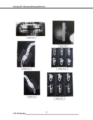 Chương III: Chọn lựa đánh giá phim tia X




                  Hình 3-8a




                                                Hình 3-8b




            Hình 3-8 c                        Hình 3-8 d




                   Hình 3-8e
                                           Hình 3-8 f




                            21
J-M. Korbendau ___________________________________
 