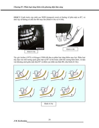 Chương IV: Phân loại răng khôn trên phương diện lâm sàng




LOẠI 3: Cạnh trước của cành cao XHD (temporal crest) có hướng về phía mặt xa R7, và
như vậy sẽ không có chỗ cho R8 mọc lên (Hình 4-14a và 4-14b).




                                                               Hình 4-14b
                 Hình 4-14a


Tác giả Archer (1975) và Kruger (1984) đã đưa ra phân loại răng khôn mọc kẹt. Phân loại
này dựa vào mối tương quan giữa mặt xa R7 và bờ trước cành lên xương hàm dưới, và dựa
vào khoảng cách giữa mặt nhai R7 và điểm cao nhất của thân R8, như hình (4-14c).




                                     Hình 4-14c




                             29
J-M. Korbendau  ___________________________________
 