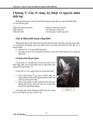 Chương V: Gây tê vùng: kỹ thuật và nguyên nhân thất bại


Chương V: Gây tê vùng: kỹ thuật và nguyên nhân
thất bại
   Đánh giá hiệu quả vô cảm thì cần thiết trong giai đoạn đầu của quá trình phẫu thuật.
Vô cảm thất bại gồm:

Thần kinh huyệt răng dưới                   Không có dấu hiệu Vincent
Thần kinh má                                Còn cảm giác ở niêm má
Thần kinh lưỡi                              Còn cảm giác ở niêm mạc lưỡi


   Gây tê thần kinh huyệt răng dưới
   Thất bại khi gây tê dây thần kinh răng dưới do thuốc gây tê không vào đúng lỗ gai Spix,
và sự khuyếch tán không xuyên qua được cành cao xương hàm dưới-vốn khá dầy. Có 2
nguyên nhân:
   • Đánh giá sai vị trí giải phẫu lỗ gai spix.
   • Sử dụng sai kim và sự khuyếch tán thuốc tê qua mô mềm không đủ tác dụng lên
       thần kinh.

   Lỗ hàm dưới (lỗ gai Spix)
   Lỗ gai spix có vị trí phía sau và dưới gai spix. Nó là
điểm thấp nhất của hố hình phễu mà bó mạch thần kinh
răng dưới đi qua (hình 5-1).

   Lỗ này thì có vị trí ở giữa cành cao xương hàm dưới:

   •   Theo chiều đứng, lỗ gai spix là điểm giữa của
       đường thẳng từ khuyếch Sigmoid đến bờ dưới của
       cành cao xương hàm dưới.
   •   Theo chiều ngang, nó nằm giữa hai điểm nằm trên
       đường chéo trong và bờ sau cành cao xương hàm
       dưới (trên một đường thẳng).

     Lưỡi hàm dưới thỉnh thoảng tạo thành một lồi xương                Hình 5-1
lồi ra, che khuất lỗ gai spix. (hình 5-2a).




                             31
J-M. Korbendau  ___________________________________
 